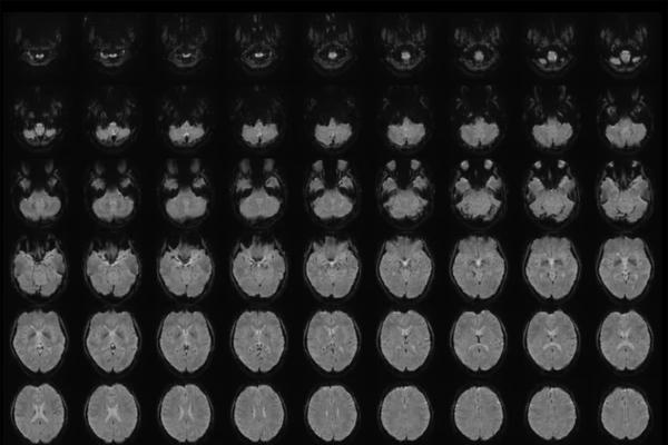 Chuyển hình ảnh trong não thành văn bản