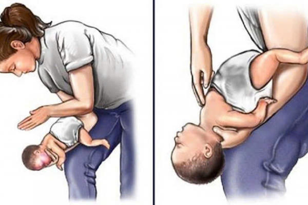 Hóc dị vật đường thở, nguy cơ tử vong cao 