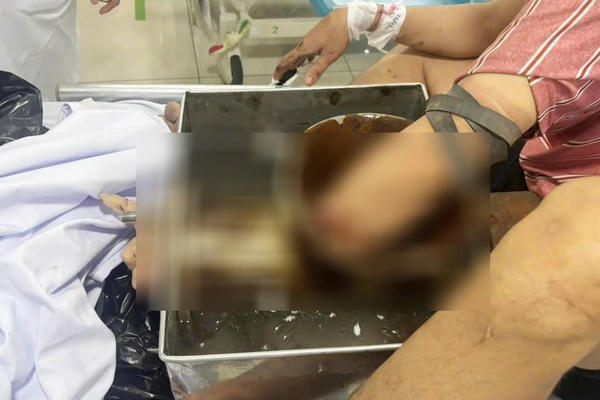 Tai nạn lao động dịp cận Tết: Hậu quả nặng nề của một phút lơ là