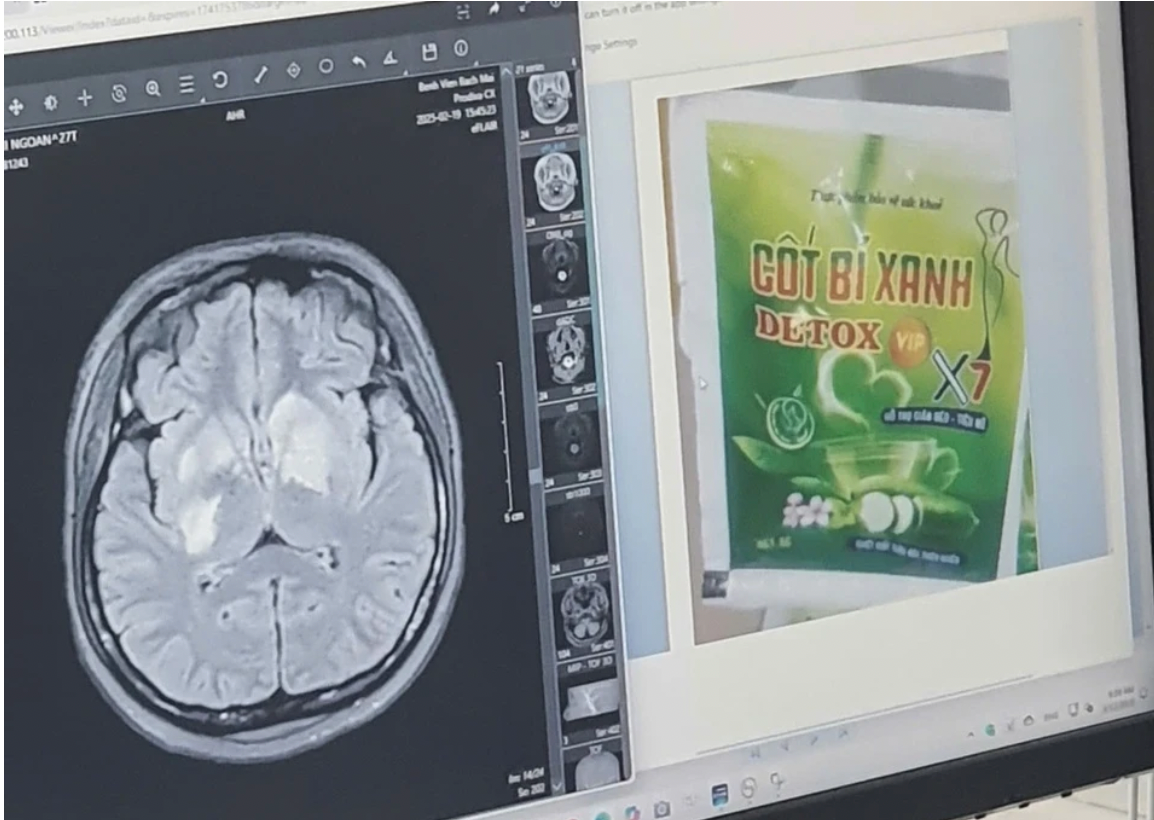 Ảnh chụp Màn hình 2025-03-13 lúc 14.21.27