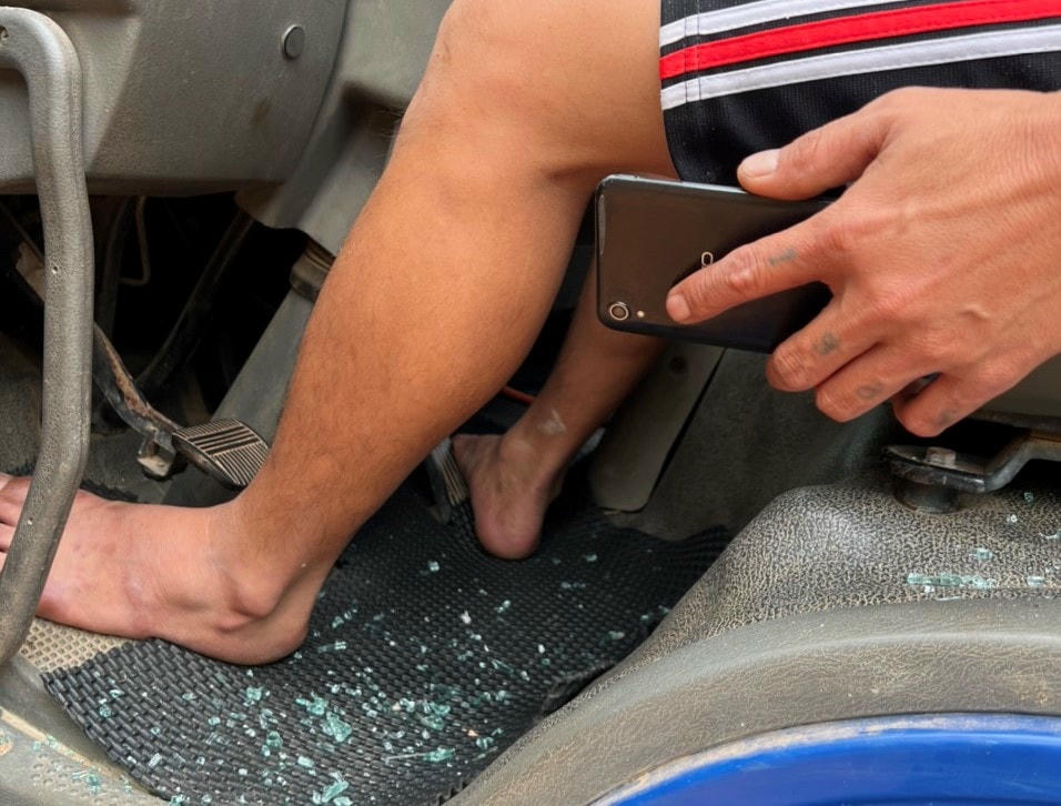 Anh Hải cho biết, đã bị mảnh gương vỡ bay vào mắt.