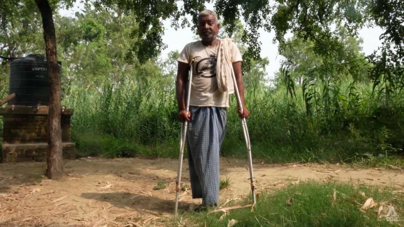 Chứng nhiễm độc thạch tín đã khiến Yadap hoại tử ở một chi, phải cắt cụt 3 lần. Ảnh: CNA.