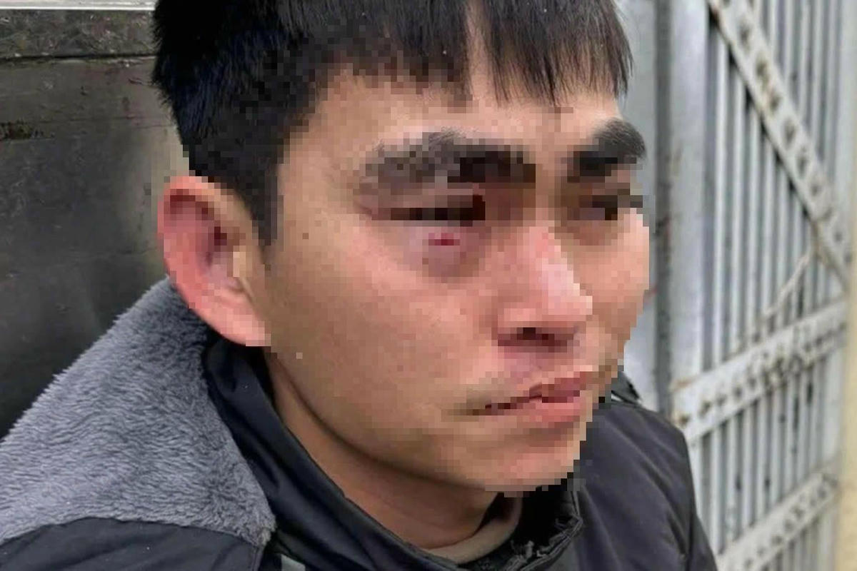 Nam shipper sau khi bị hành hung.