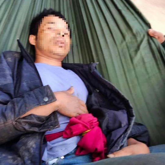 Anh G. bị một con trâu trong đàn húc thủng bụng và phải đưa đi cấp cứu tại bệnh viện (Ảnh: NK).