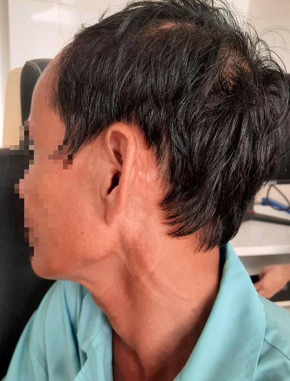 Bệnh nhân được tiếp tục theo dõi sức khỏe tại Bệnh viện Đa khoa tỉnh Quảng Trị.