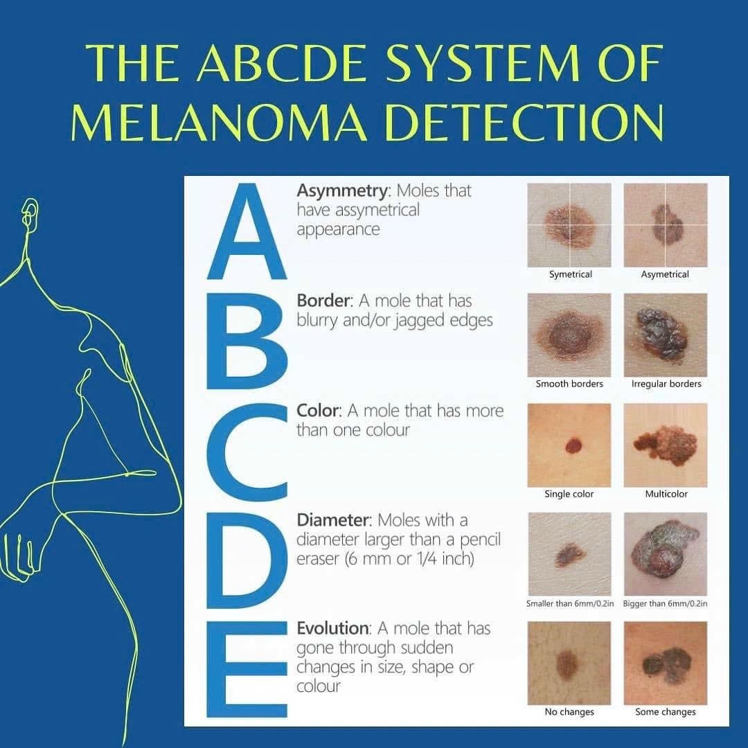 dau hieu canh bao UTD