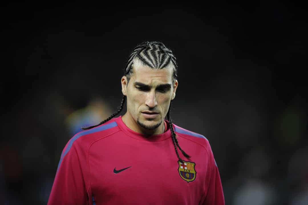 Cựu thủ môn José Manuel Pinto không ít lần bị bắt gặp với vẻ ngoài ngô nghê này.  