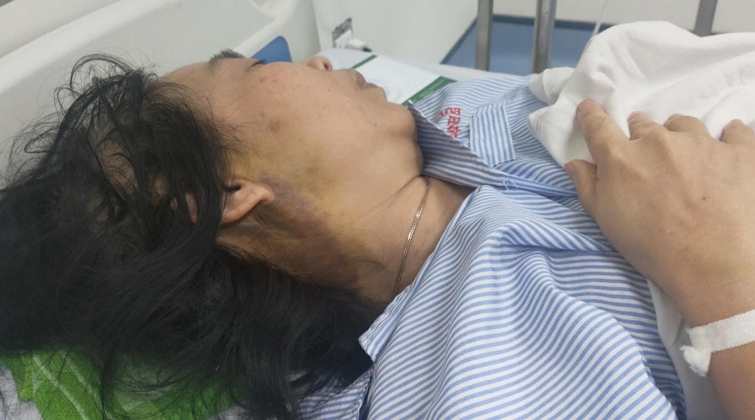 Vụ bà Lê Thị Bích Dung bị hành hung: Cần xử lý nghiêm trách nhiệm của từng cá nhân liên quan