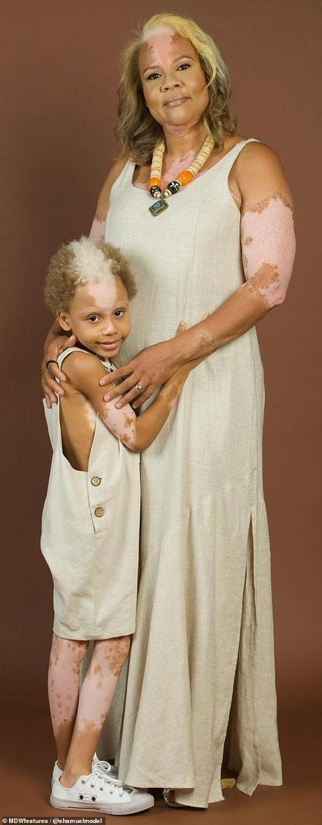 Ngay khi cậu bé Samuel quyết định nuôi tóc, không cạo trọc nữa, các công ty người mẫu đã bắt đầu tìm tới cậu bé từ tháng 4/2019.  