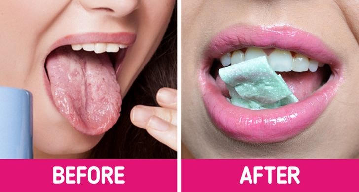 9 cách chữa lành vết bỏng lưỡi sau khi ăn đồ nóng