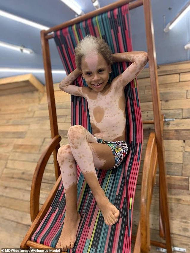 Cậu bé Samuel Silva (7 tuổi) đến từ Bahia, Brazil.  