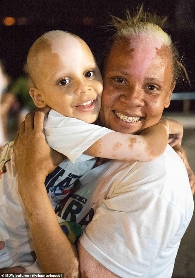 Samuel và mẹ khi cậu bé còn hay cạo trọc đầu.  