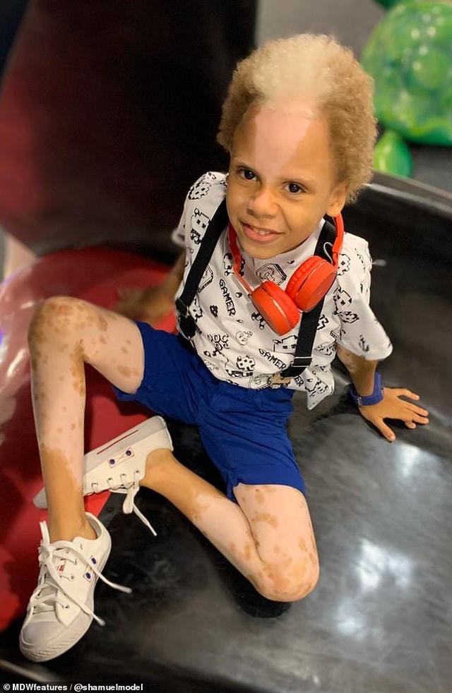 Samuel cũng thích được quan tâm chú ý, thích đi du lịch.  