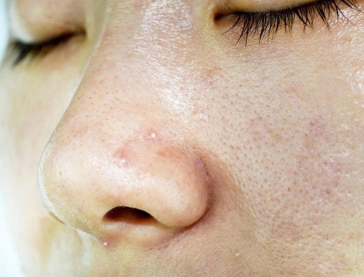 Trang điểm khi ngủ - lợi hay hại?