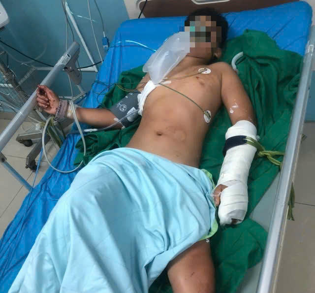 Cháu bé sống sót trong vụ thảm án tại Đắk Lắk đang được điều trị tích cực. Ảnh: TN.