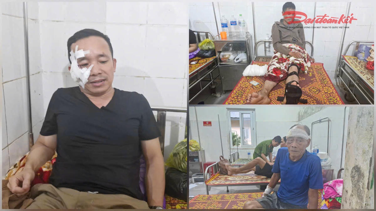 3 trong số 6 nạn nhân đang điều trị tại Bệnh viện Đa khoa khu vực Hướng Hóa. Ảnh: Đỗ Văn.