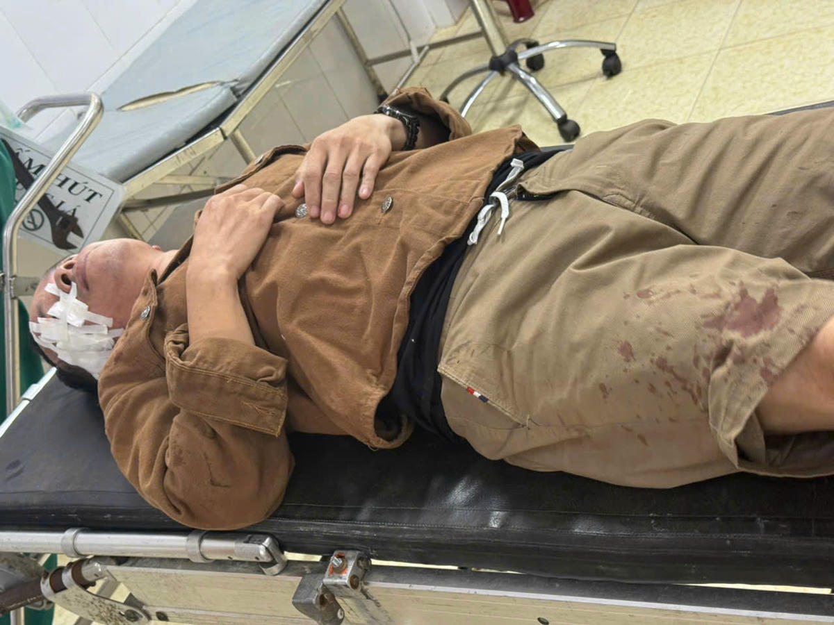 Và nhiều người khác bị thương. Ảnh: CTV.