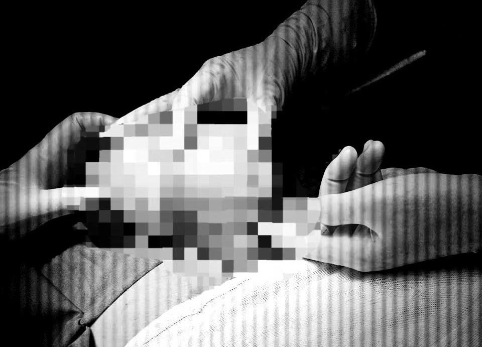 Khối u được lấy ra khỏi cơ thể bệnh nhân an toàn. Ảnh: TTYT.