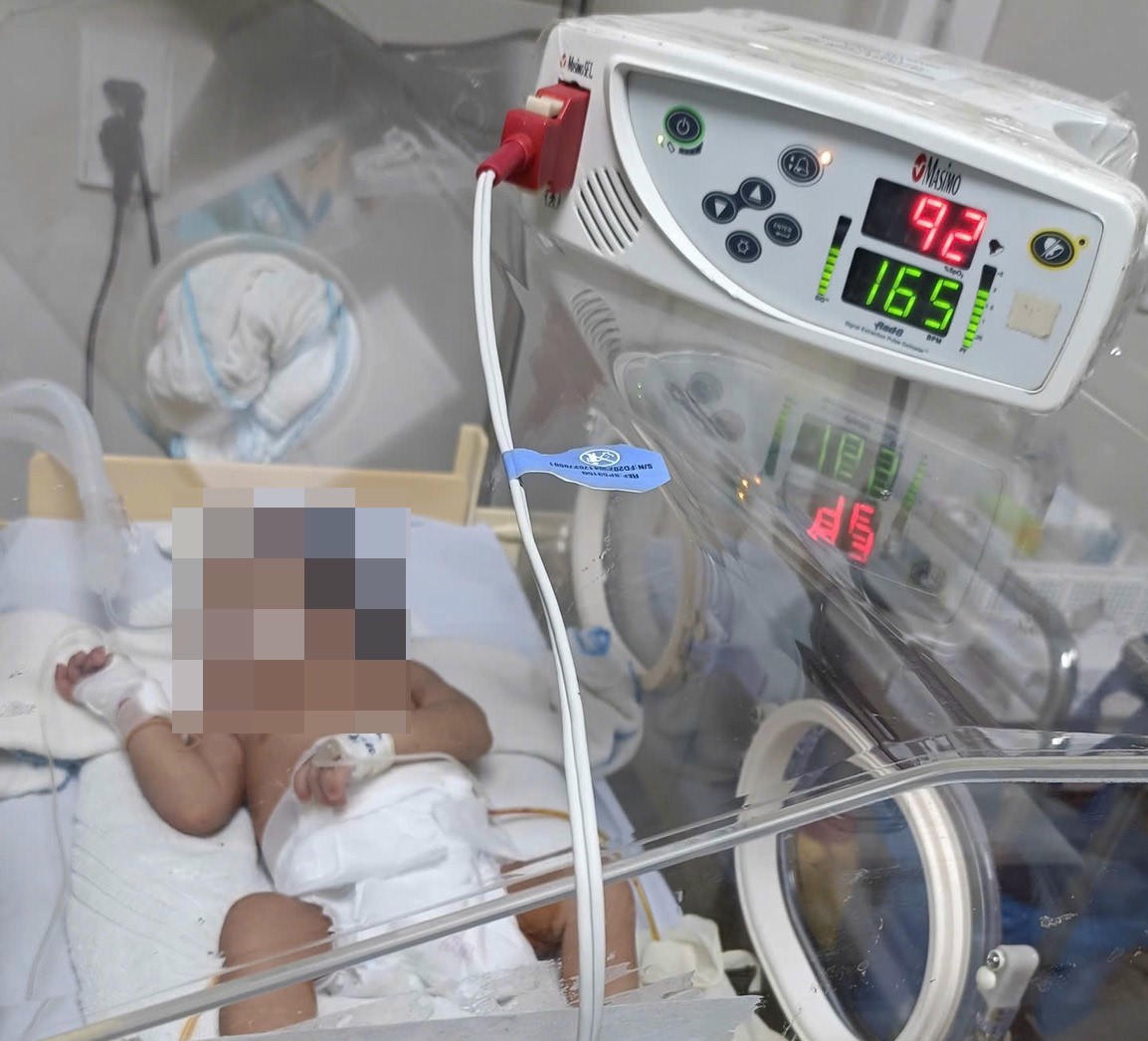 Cháu Y.M. điều trị tại bệnh viện với triệu chúng thủng dạ dày do ăn cơm, dẫn đến nhiễm khuẩn huyết. Ảnh: BVCC.