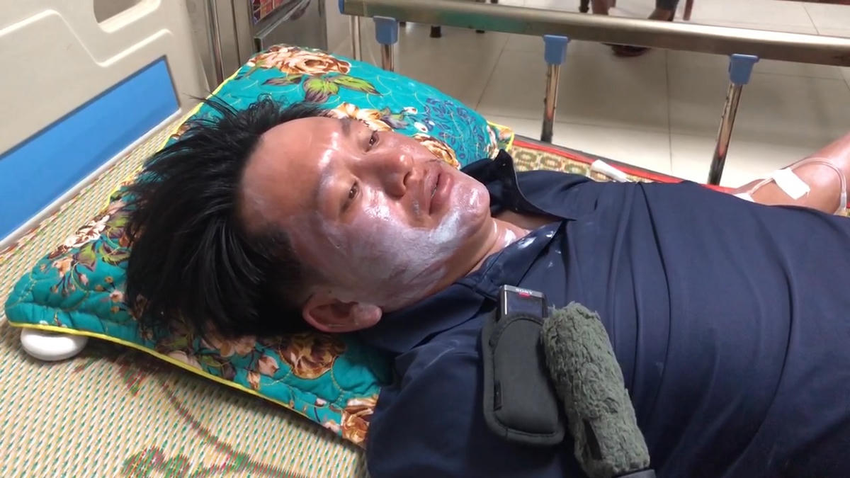 Anh Lê Văn Sanh kể lại giây phút sinh tử. Ảnh: Tấn Thành.