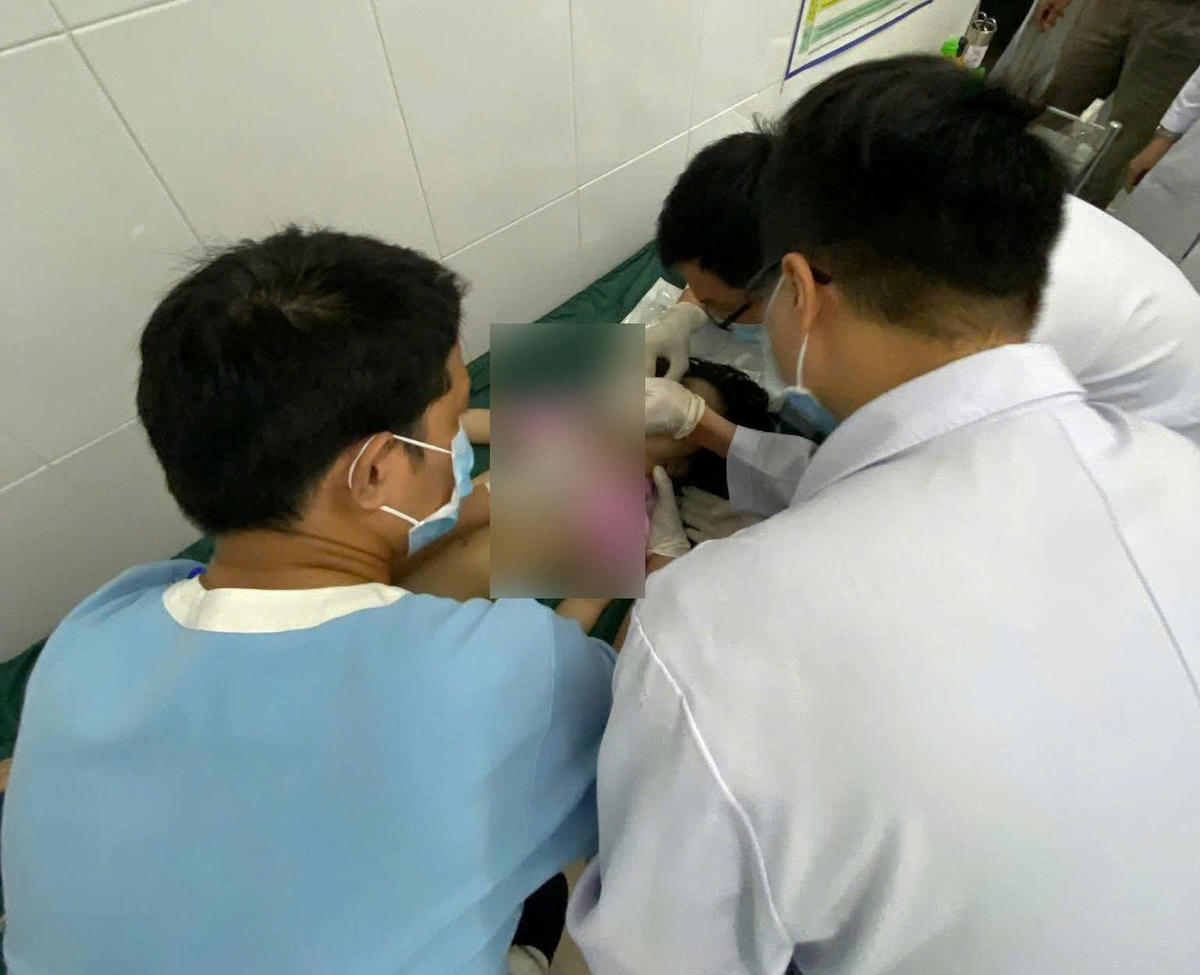 Các bác sĩ tích cực cấp cứu nhưng bệnh nhi không qua khỏi. Ảnh: T.L