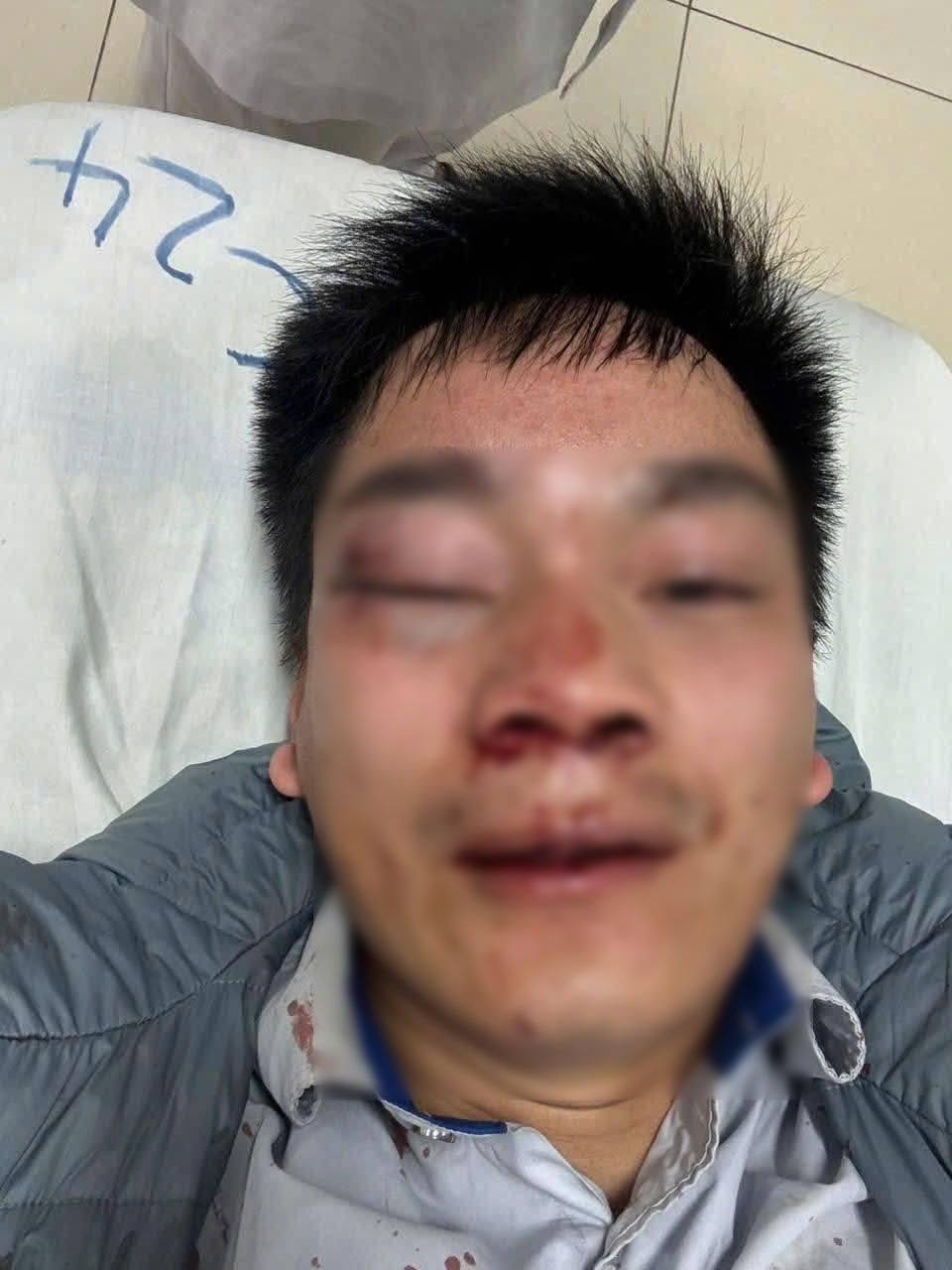 Hình ảnh tài xế lái xe buýt sau khi bị hành hung.