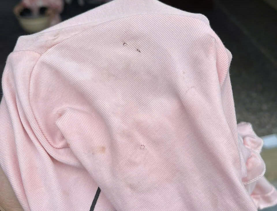 Chiếc cáo bé T.N mặc hôm xảy ra sự việc bị thủng nhiều lỗ. Ảnh: HT.