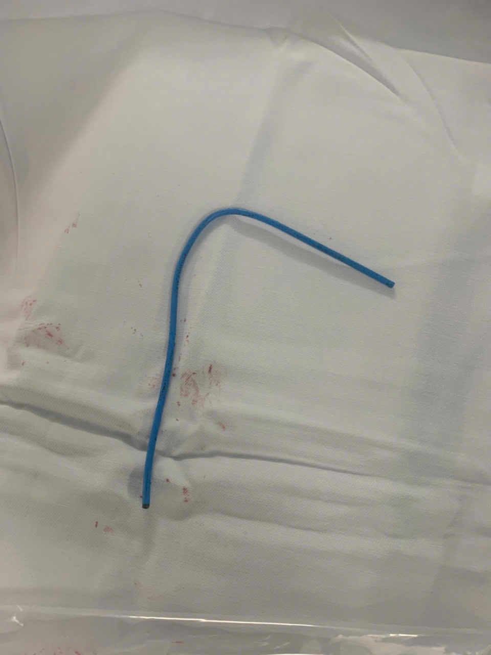 Ống thông truyền hóa chất sau khi được lấy ra. Ảnh: BV