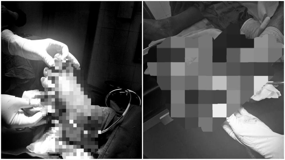 Bệnh nhân đã được chỉ định phẫu thuật cấp cứu. Ảnh: TT.