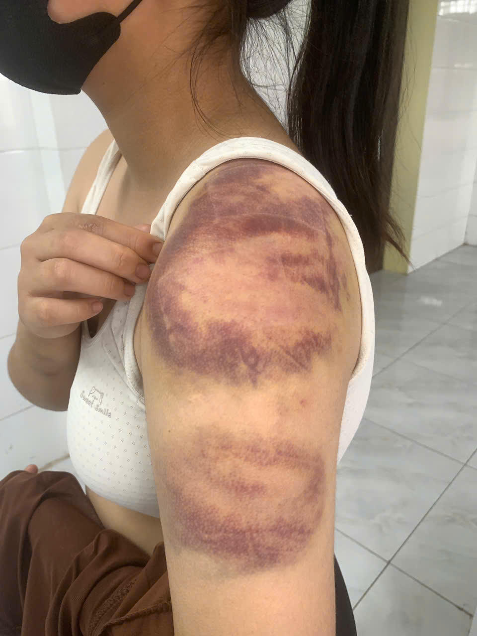 Cháu Phan Thị M.T. bị bố đẻ đánh gây thương tích.