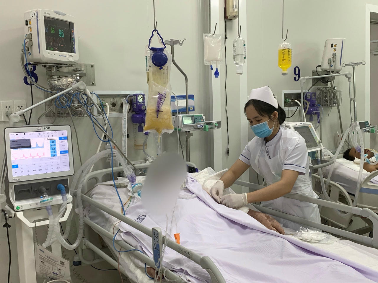 Trước đó, thiếu thuốc BAT, bệnh viện phải sử dụng phác đồ điều trị khác cho bệnh nhân. 