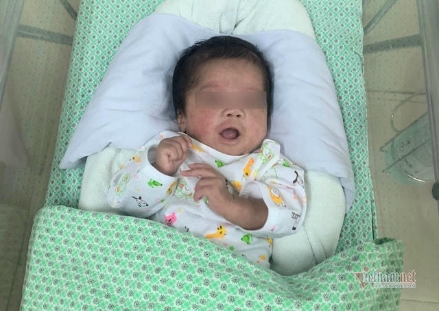 Bé Bình An thời điểm được đưa vào cấp cứu tại Khoa Sơ sinh, Bệnh viện Đa khoa Xanh Pôn.