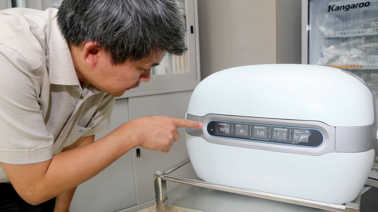 Lần đầu tiên máy LifePort được đưa vào bảo quả tạng ghép thay cho phương pháp bảo quản truyền thống. Ảnh: L.H.