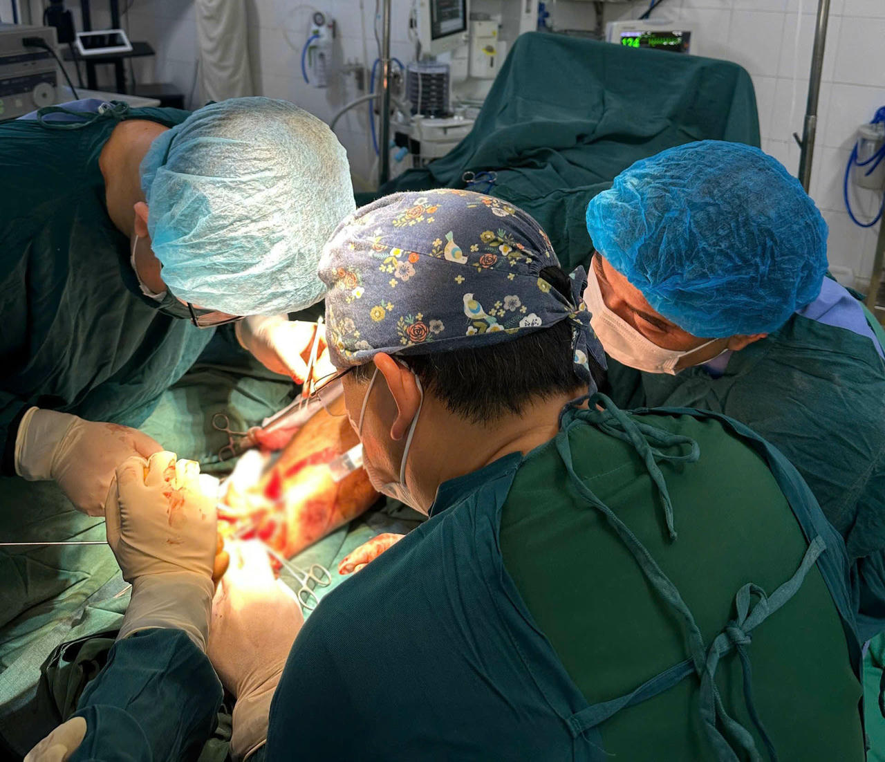 Đây là ca bệnh đứt rời chân thứ 2 được các bác sĩ của Bệnh viện Đa khoa tỉnh Điện Biên nối thành công. Ảnh: CTV.