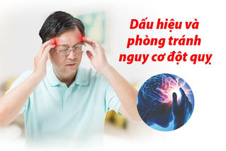 Cảnh báo dấu hiệu tiền đột quỵ và cách dự phòng hiệu quả