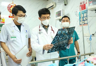 Bệnh nhân đột quỵ não cần làm gì để hạn chế tái phát?