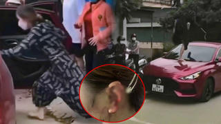 Đi đánh ghen 1 mình, người phụ nữ đạp vỡ kính ô tô, cắn đứt tai một cô gái