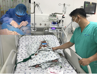 Bé 3 tháng tuổi xuất huyết tiêu hóa nặng do nhiễm giun