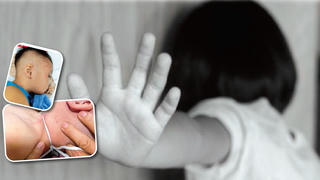 Bạo lực trẻ em: Những vết thương bao giờ lành?