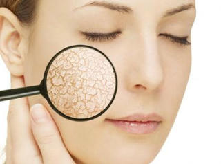 6 sai lầm khiến da nứt nẻ, gây ngứa vào ngày lạnh