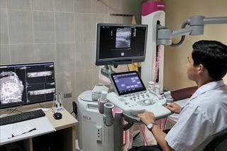 Cân nhắc quyết định tầm soát ung thư