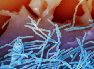 Mỹ phê duyệt vaccine phòng virus hợp bào hô hấp