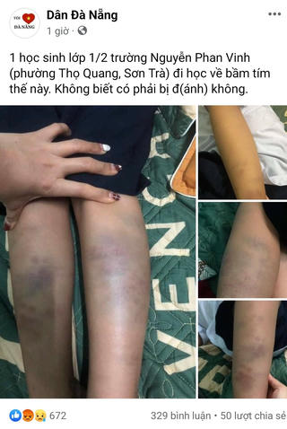 Đà Nẵng: Tiếp tục điều tra vụ học sinh lớp 1 nghi bị bạo hành
