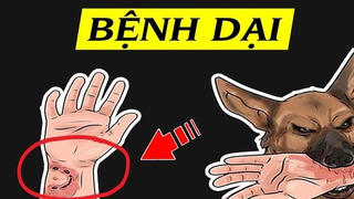 Cấp bách phòng bệnh dại