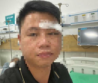 Đà Nẵng: Một luật sư bị nhóm người lạ mặt hành hung gây thương tích