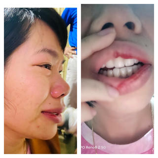 Đắk Nông: Con bị hạnh kiểm trung bình, thầy giáo đến tận nhà hành hung nữ đồng nghiệp