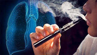 Dùng thuốc lá điện tử, nam sinh 16 tuổi tổn thương phổi nặng nề