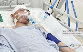 Vụ nam sinh lớp 8 bị đánh chấn thương não: Không có 'phép màu' nào xảy ra