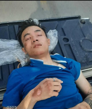 Làm rõ một thanh niên câm điếc bị đánh thoi thóp ngoài nghĩa địa