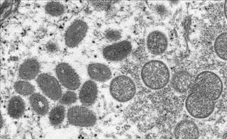 Bệnh đậu mùa khỉ: Phát hiện ca nghi nhiễm virus đầu tiên từ người sang chó